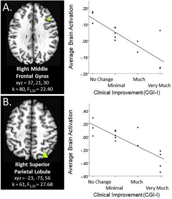Social and Non-social Reward: A Preliminary Examination of Clinical Improvement and Neural Reactivity in Adolescents Treated With Behavioral Therapy for Anxiety and Depression